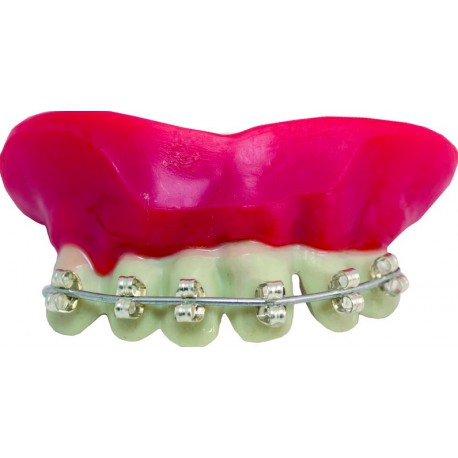 Dentier rigide avec pâte - dents argentées